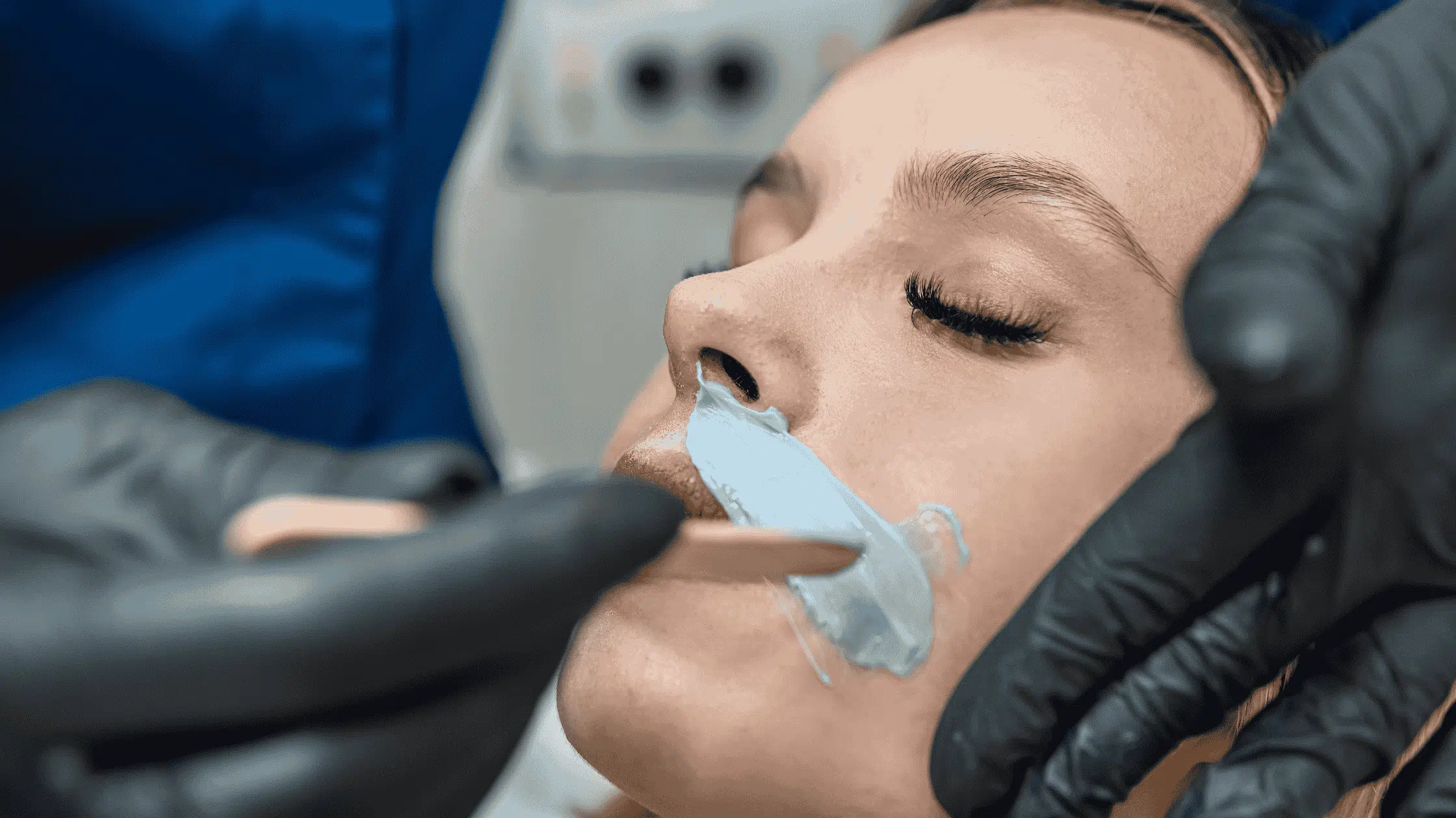 Excess Hair Groth on Menopausal Woman having waxing proceedure - HairZglam