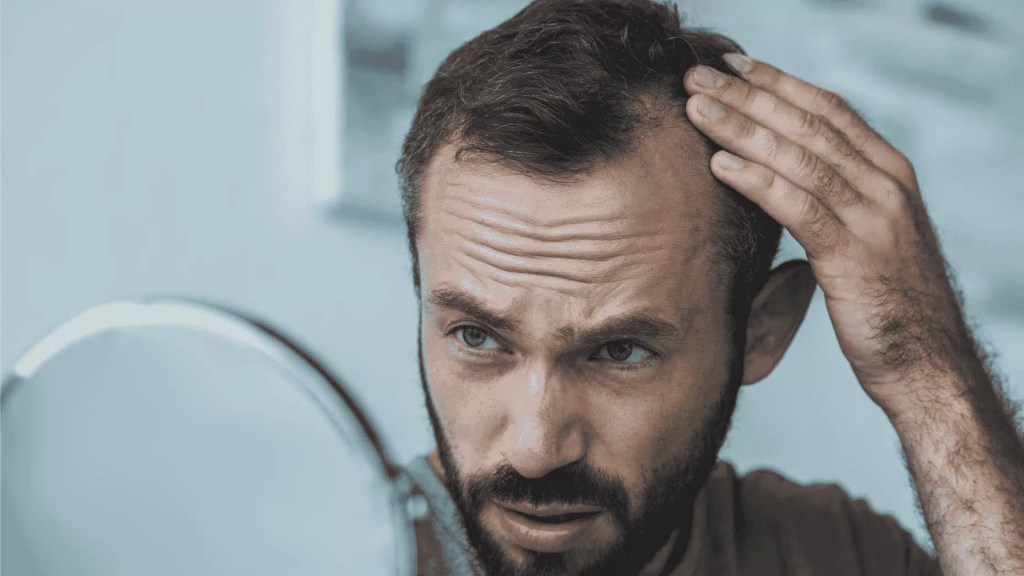 Alopecia Sufferers - 9 Crucial Things To Know For Happier Life - HairZglam