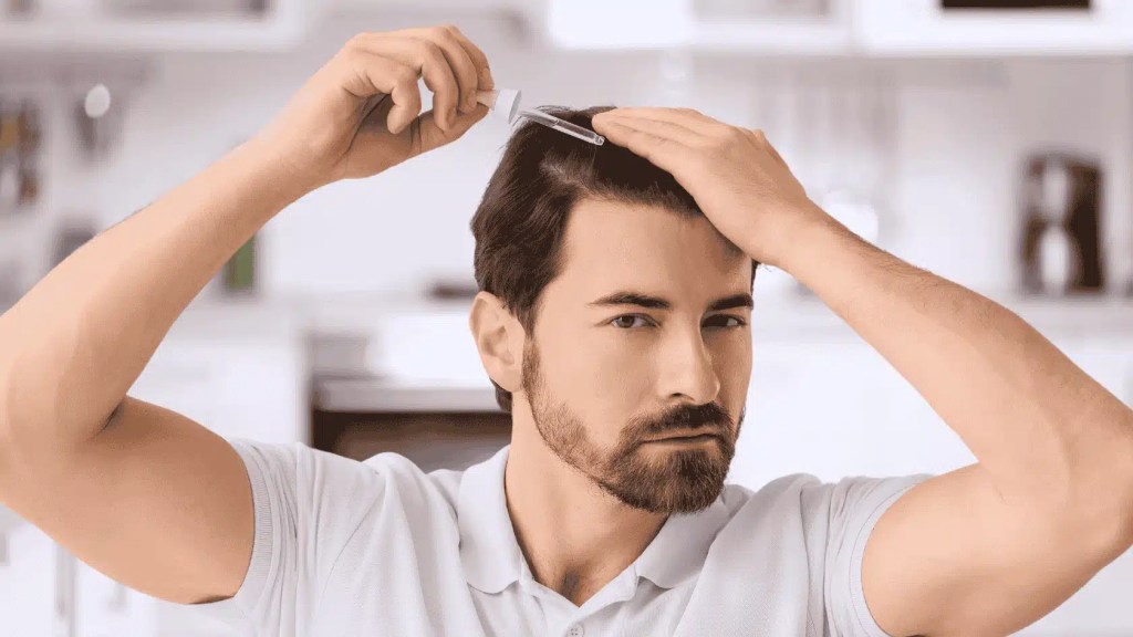 5 of Our Best Products For Men With Hair Loss (Even In Your 20s) - HairZglam