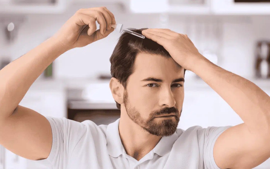 5 Best Hair Loss Products for Men (Even in Your 20s)